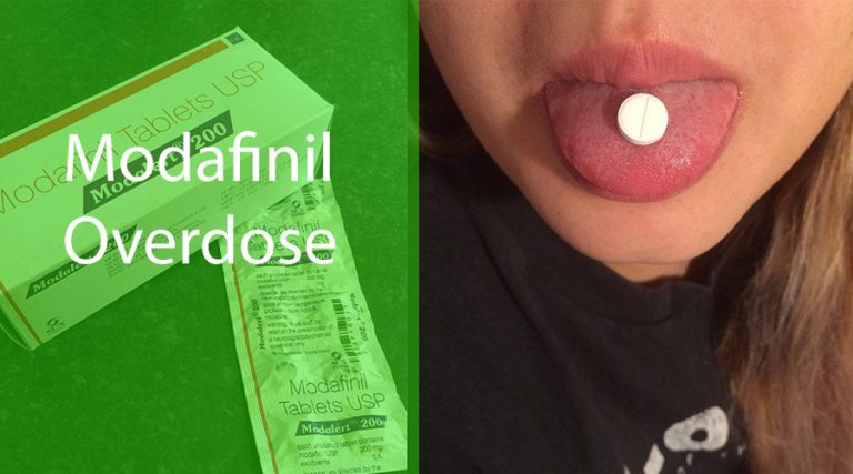 Modafinil overdose